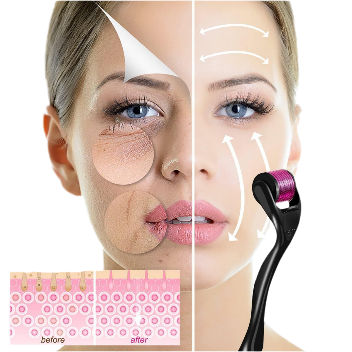 Derma Roller