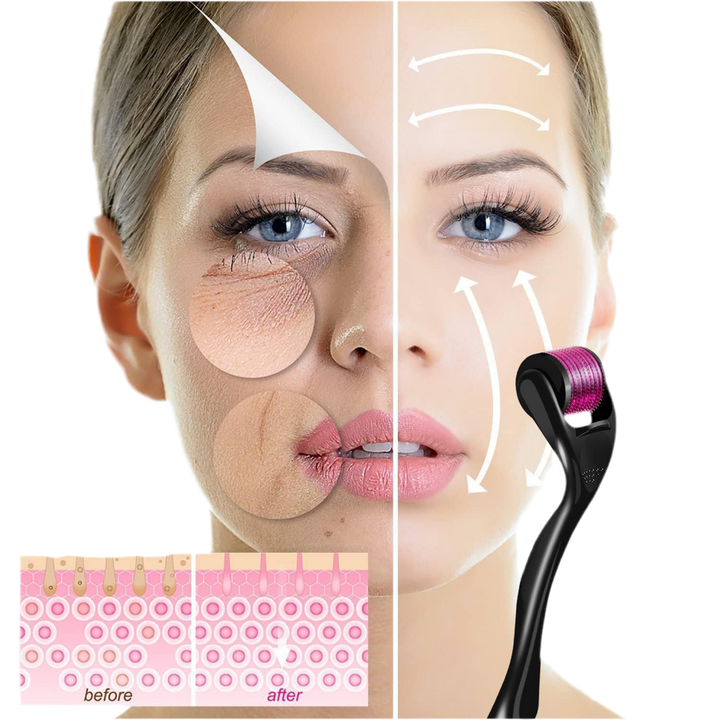 Derma Roller